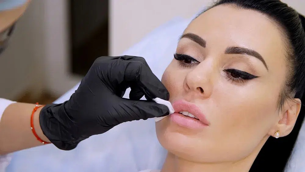 uneven lips, lip symmetry, lip imbalance, lip shape