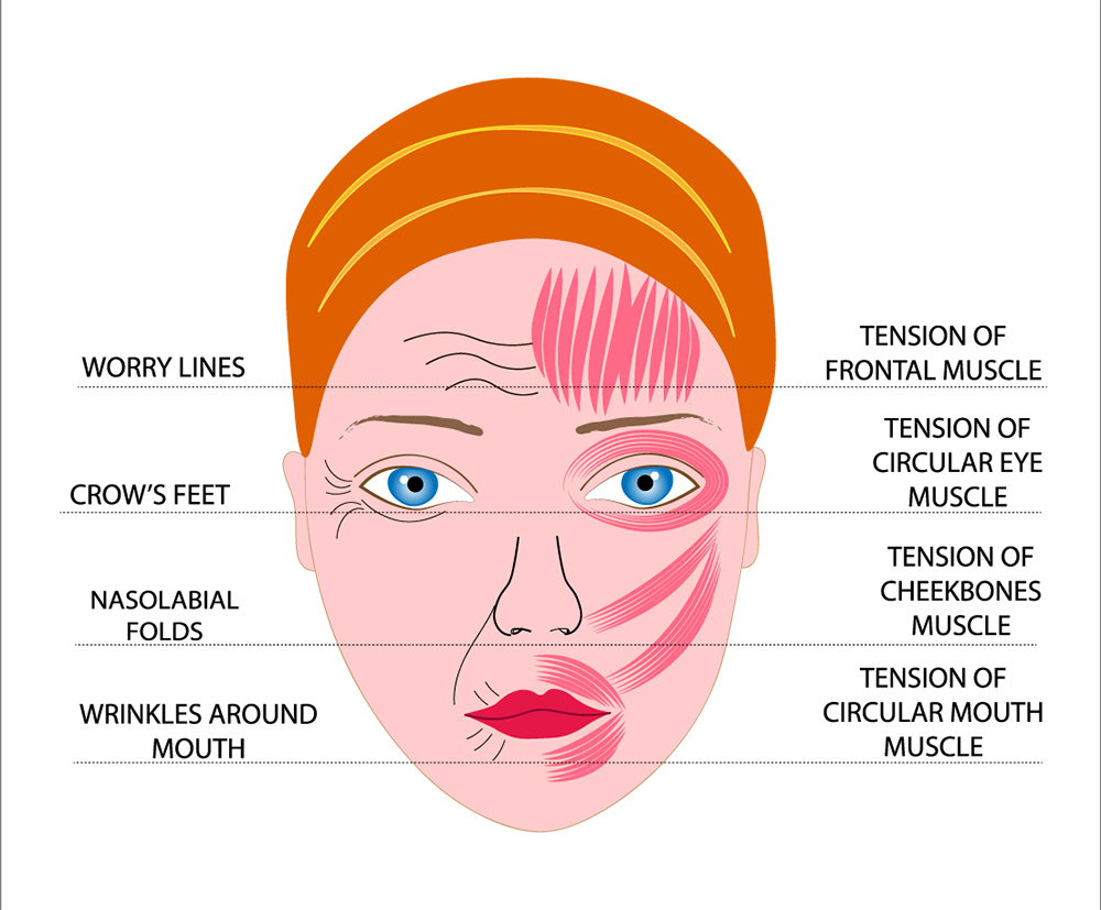 fine lines and wrinkles treatment, skin texture, surface changes