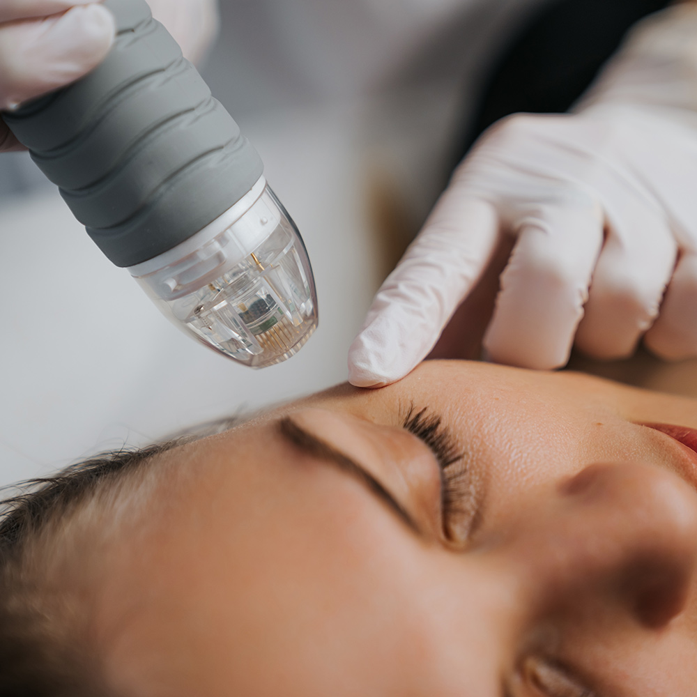 fine lines and wrinkles treatment, skin structure, firmness, natural processes