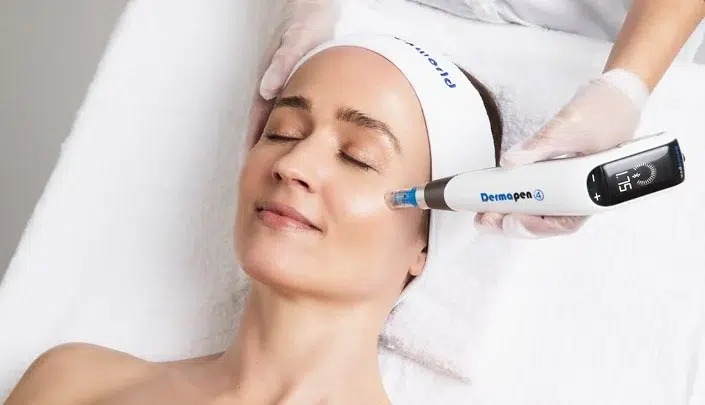 acne scars treatment, rolling scars, boxcar scars, ice pick scars