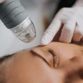 types of acne scars different types of acne scars acne scar types acne scar classification