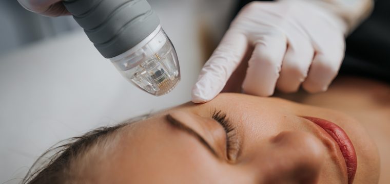 types of acne scars different types of acne scars acne scar types acne scar classification