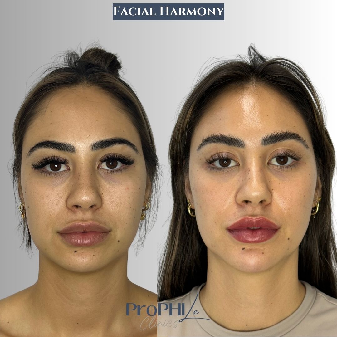skin analysis consultation, skin consultation, skin analysis, skin imaging consultation