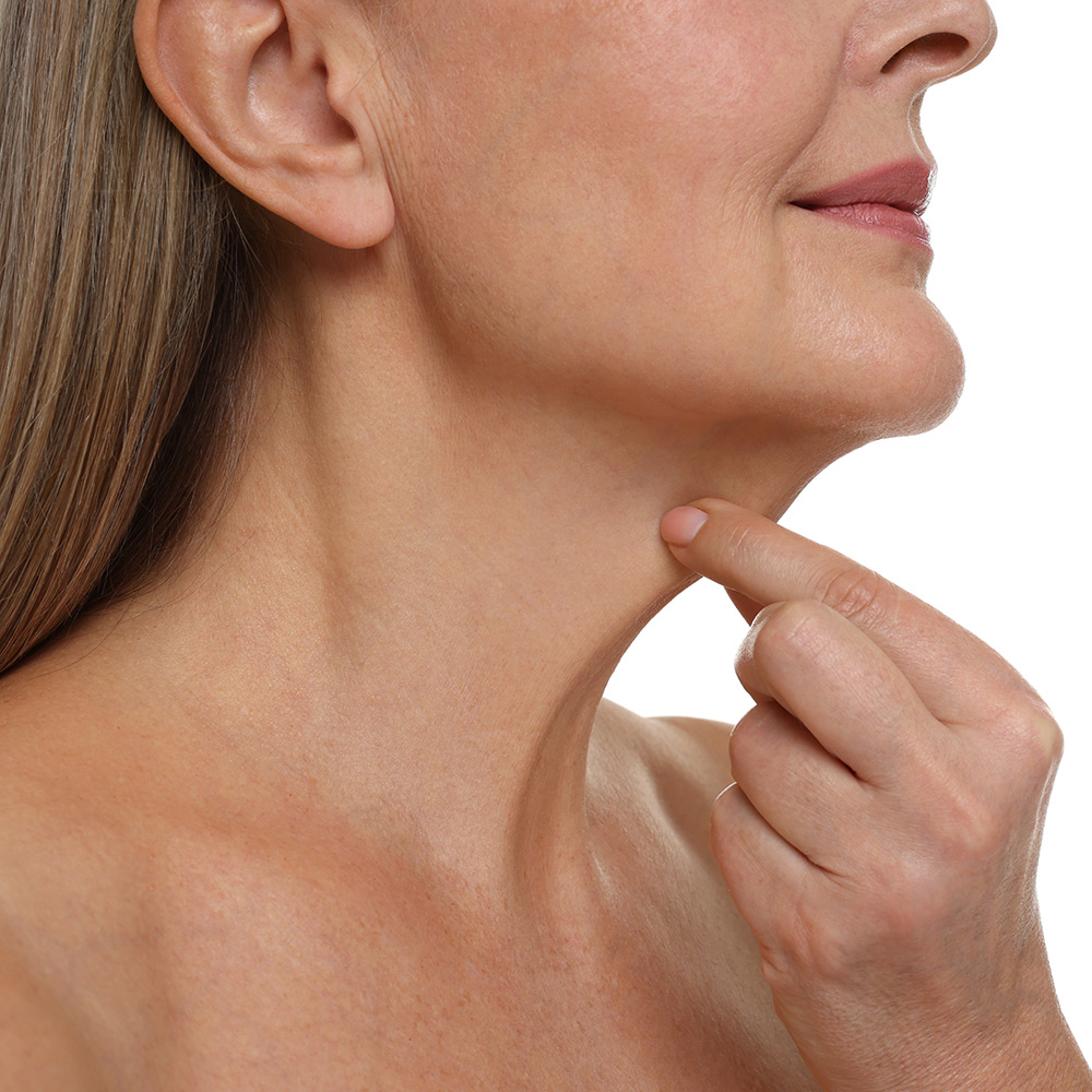 Concerns About the Chin and Neck Area