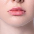 how to fix uneven lips uneven lips lip asymmetry uneven lip shape