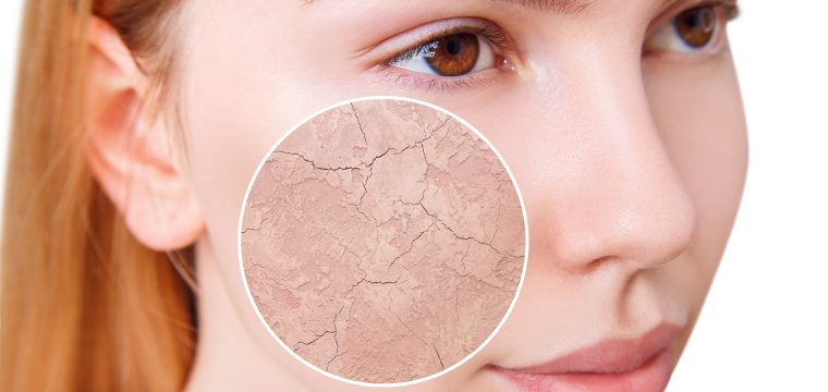 dry vs dehydrated skin, signs of dehydrated skin, skin hydration and barrier