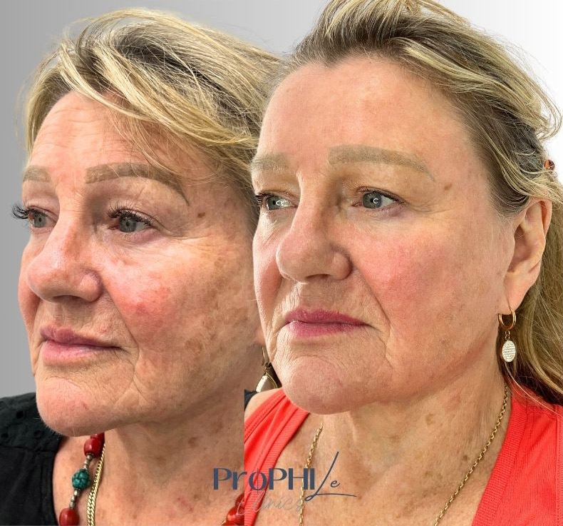 how skin changes with age, signs of premature ageing, intrinsic vs extrinsic ageing