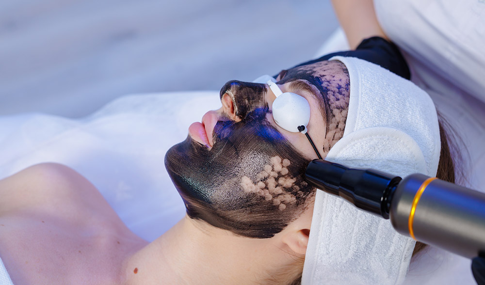 carbon laser facial, carbon facial treatment process, laser treatment settings