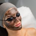 carbon laser facial, carbon facial treatment, laser facial for pores, carbon peel treatment