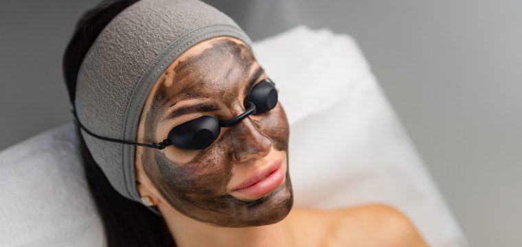 carbon laser facial, carbon facial treatment, laser facial for pores, carbon peel treatment