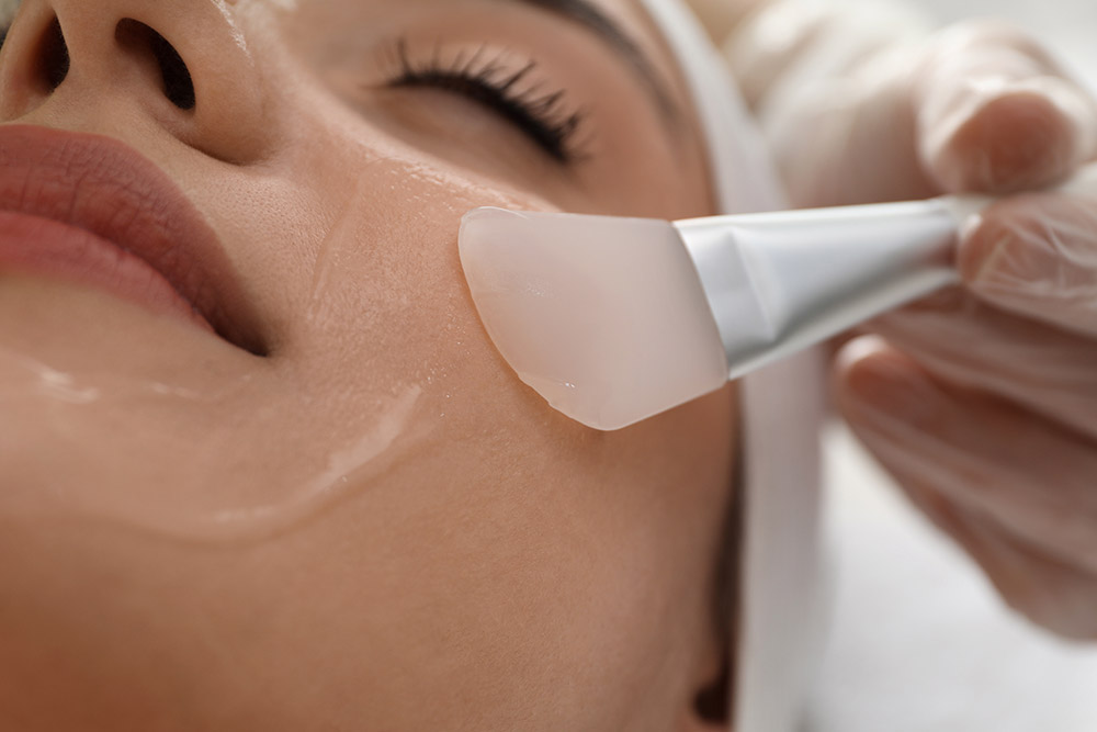 how do chemical peels work, chemical peel application, chemical peel treatment process, professional skin peel